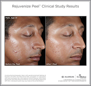 Rej_Peel_CS_Male_Age31
