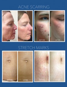 RPbefore&afters-3-2-2-2