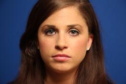 rhinoplasty-macon rhinoplasty-macon
