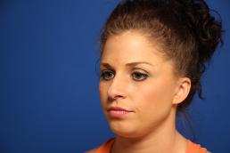 rhinoplasty-macon rhinoplasty-macon